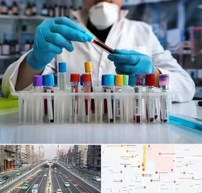 آزمایشگاه خون در توحید