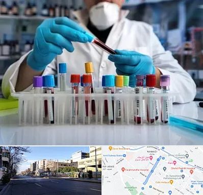 آزمایشگاه خون در خیابان ملاصدرا شیراز
