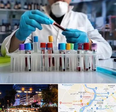 آزمایشگاه خون در کیانپارس اهواز