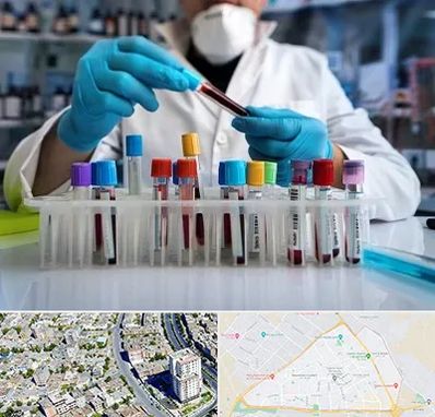 آزمایشگاه خون در قاسم آباد مشهد
