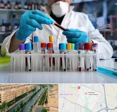 آزمایشگاه خون در فاز سه اندیشه