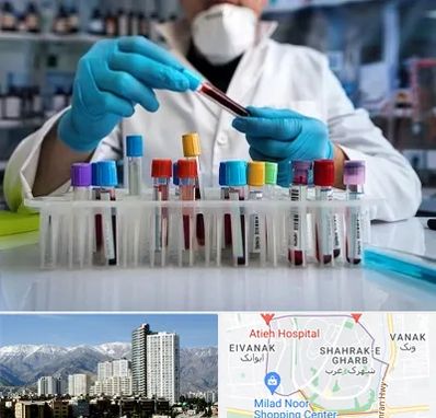 آزمایشگاه خون در شهرک غرب