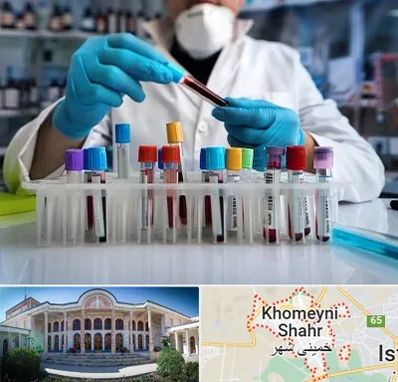 آزمایشگاه خون در خمینی شهر