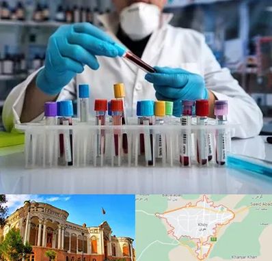 آزمایشگاه خون در خوی