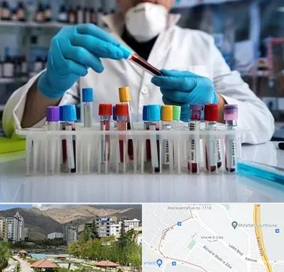 آزمایشگاه خون در شهر زیبا