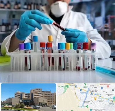 آزمایشگاه خون در صیاد شیرازی مشهد