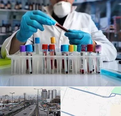آزمایشگاه خون در بلوار ارتش