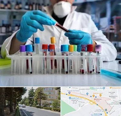 آزمایشگاه خون در مهرویلا کرج