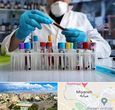 آزمایشگاه خون در میانه