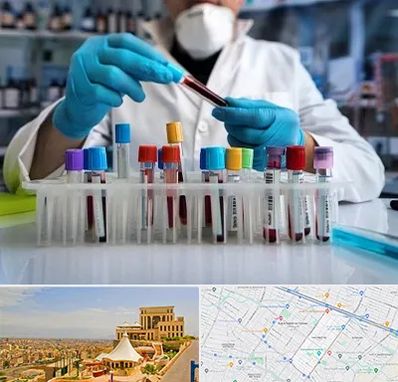 آزمایشگاه خون در هاشمیه مشهد