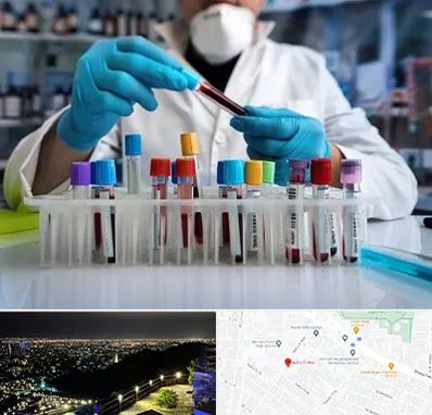 آزمایشگاه خون در هفت تیر مشهد