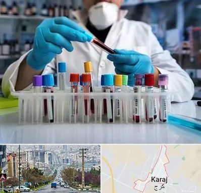 آزمایشگاه خون در گوهردشت کرج