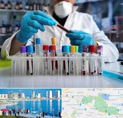 آزمایشگاه خون در چیتگر