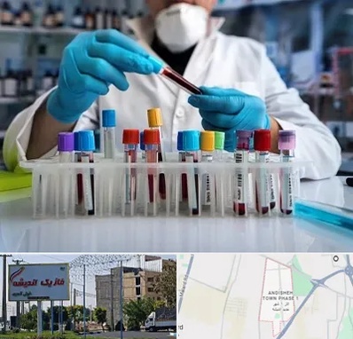 آزمایشگاه خون در فاز یک اندیشه