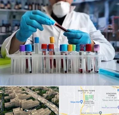 آزمایشگاه خون در اکباتان