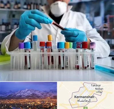 آزمایشگاه خون در کرمانشاه