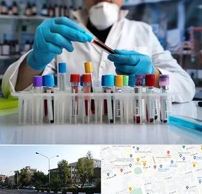 آزمایشگاه خون در میدان کاج
