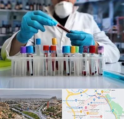 آزمایشگاه خون در معالی آباد شیراز