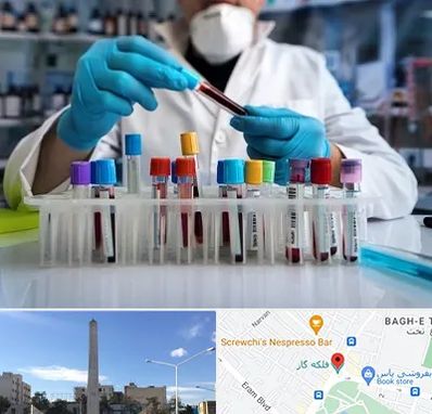 آزمایشگاه خون در فلکه گاز شیراز