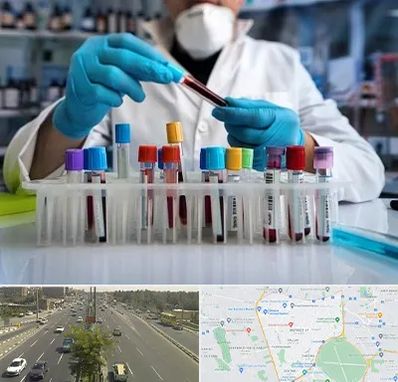 آزمایشگاه خون در منطقه 17 تهران