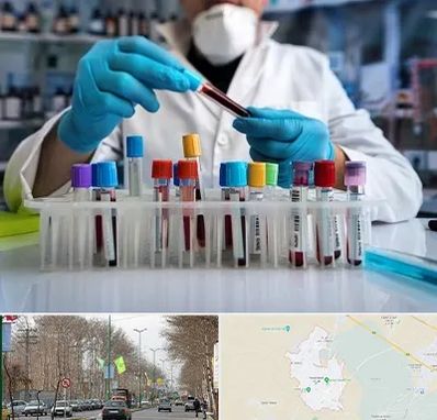 آزمایشگاه خون در نظرآباد کرج