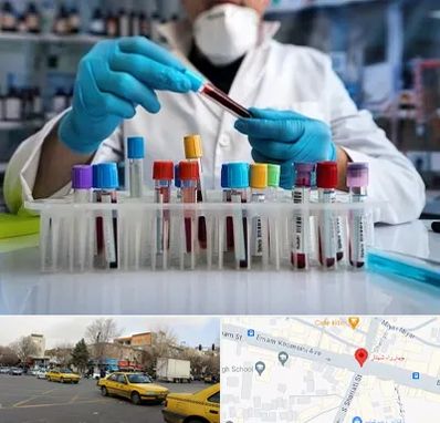 آزمایشگاه خون در شهناز تبریز