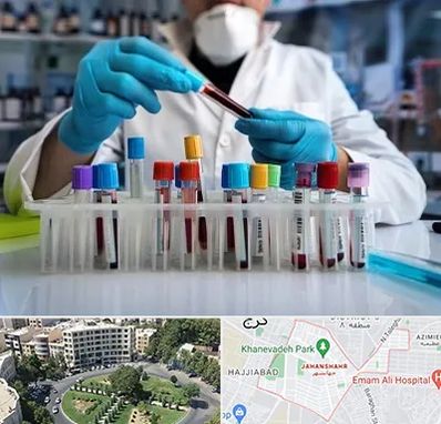 آزمایشگاه خون در جهانشهر کرج