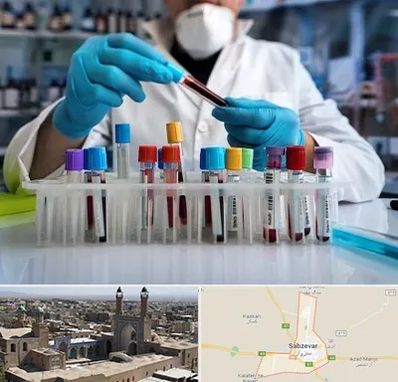 آزمایشگاه خون در سبزوار
