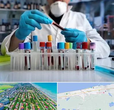 آزمایشگاه خون در فریدونکنار