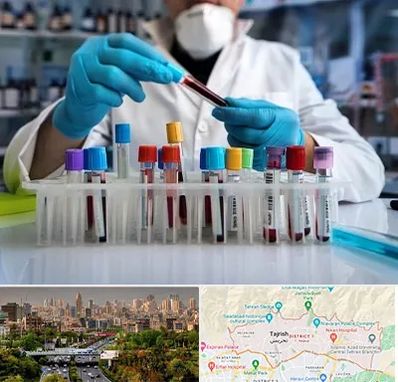 آزمایشگاه خون در منطقه 1 تهران