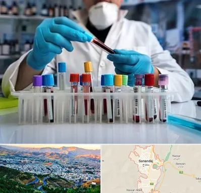 آزمایشگاه خون در سنندج