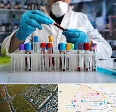 آزمایشگاه خون در الهیه مشهد