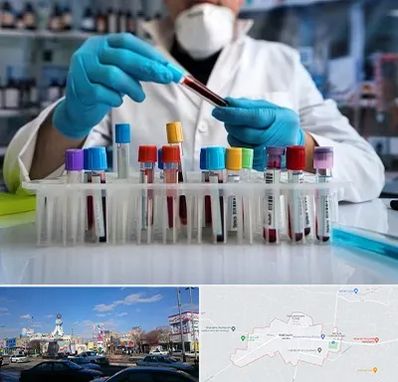 آزمایشگاه خون در ماهدشت کرج