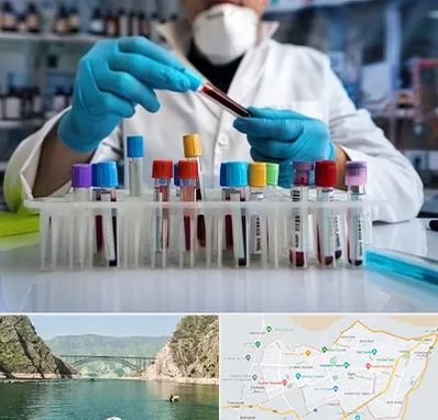 آزمایشگاه خون در ایلام