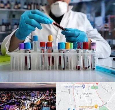 آزمایشگاه خون در گلسار رشت