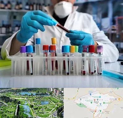 آزمایشگاه خون در بجنورد