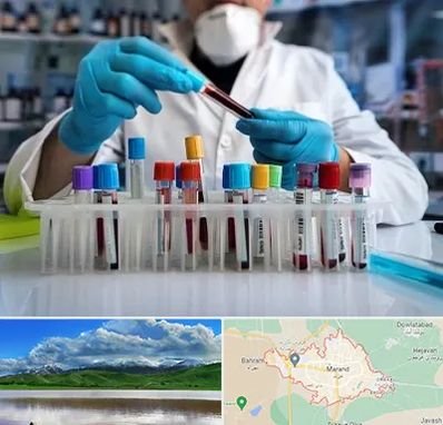 آزمایشگاه خون در مرند