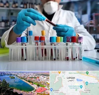 آزمایشگاه خون در لاهیجان