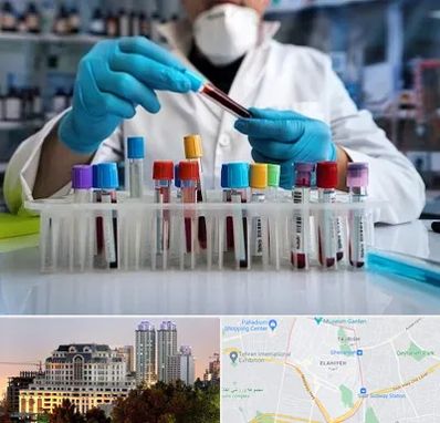 آزمایشگاه خون در فرشته