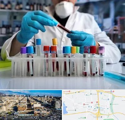 آزمایشگاه خون در شهرک راه آهن
