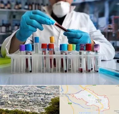 آزمایشگاه خون در یاسوج