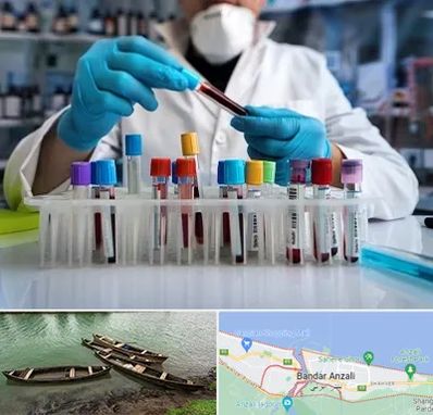 آزمایشگاه خون در بندر انزلی