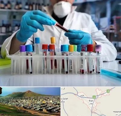 آزمایشگاه خون در بیجار