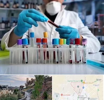 آزمایشگاه خون در باغستان کرج