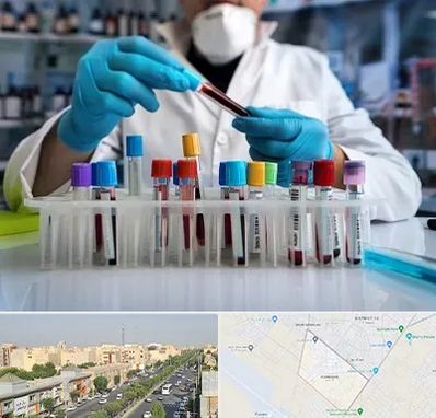 آزمایشگاه خون در کیانمهر کرج
