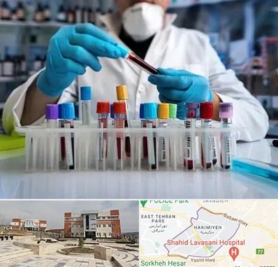 آزمایشگاه خون در حکیمیه