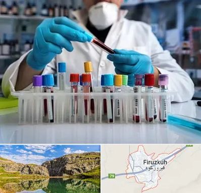 آزمایشگاه خون در فیروزکوه