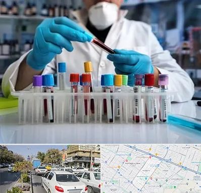 آزمایشگاه خون در مفتح مشهد