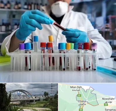 آزمایشگاه خون در چالوس
