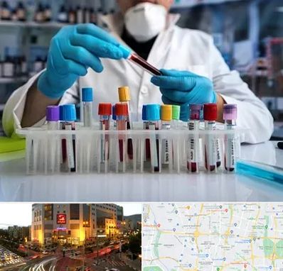 آزمایشگاه خون در جنت آباد تهران